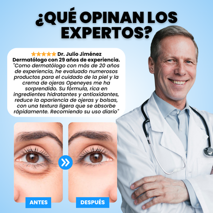 Crema Anti-Ojeras: Elimina 100% Bolsas en Días - OpenEyes™ (1+1 GRATIS)