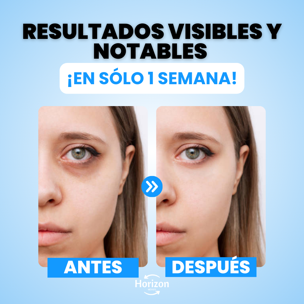 Crema Anti-Ojeras: Elimina 100% Bolsas en Días - OpenEyes™ (1+1 GRATIS)