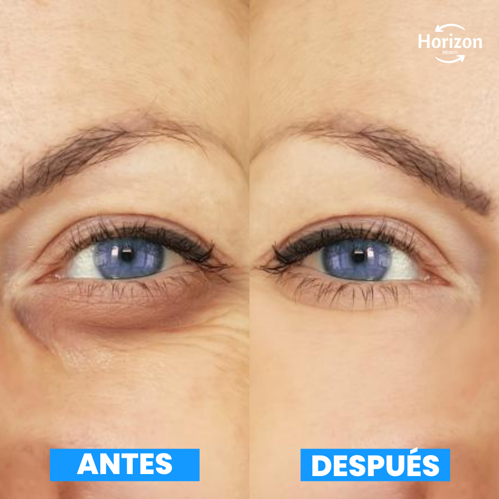 Crema Anti-Ojeras: Elimina 100% Bolsas en Días - OpenEyes™ (1+1 GRATIS)